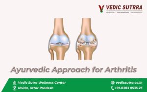 Ayurvedic Approach for Arthritis Can Ayurveda Offer Relief